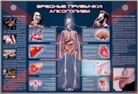 Электрифицированный стенд "Вредные привычки: алкоголизм" - «globural.ru» - Тольятти