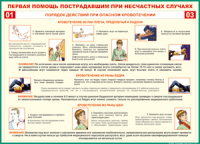 Таблица Порядок действий при опасном кровотечении 1000*1400 винил - «globural.ru» - Тольятти