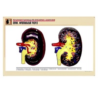 Рельефная таблица "Почка. Фронтальный разрез" (формат А1, матовое ламинир.) - «globural.ru» - Тольятти